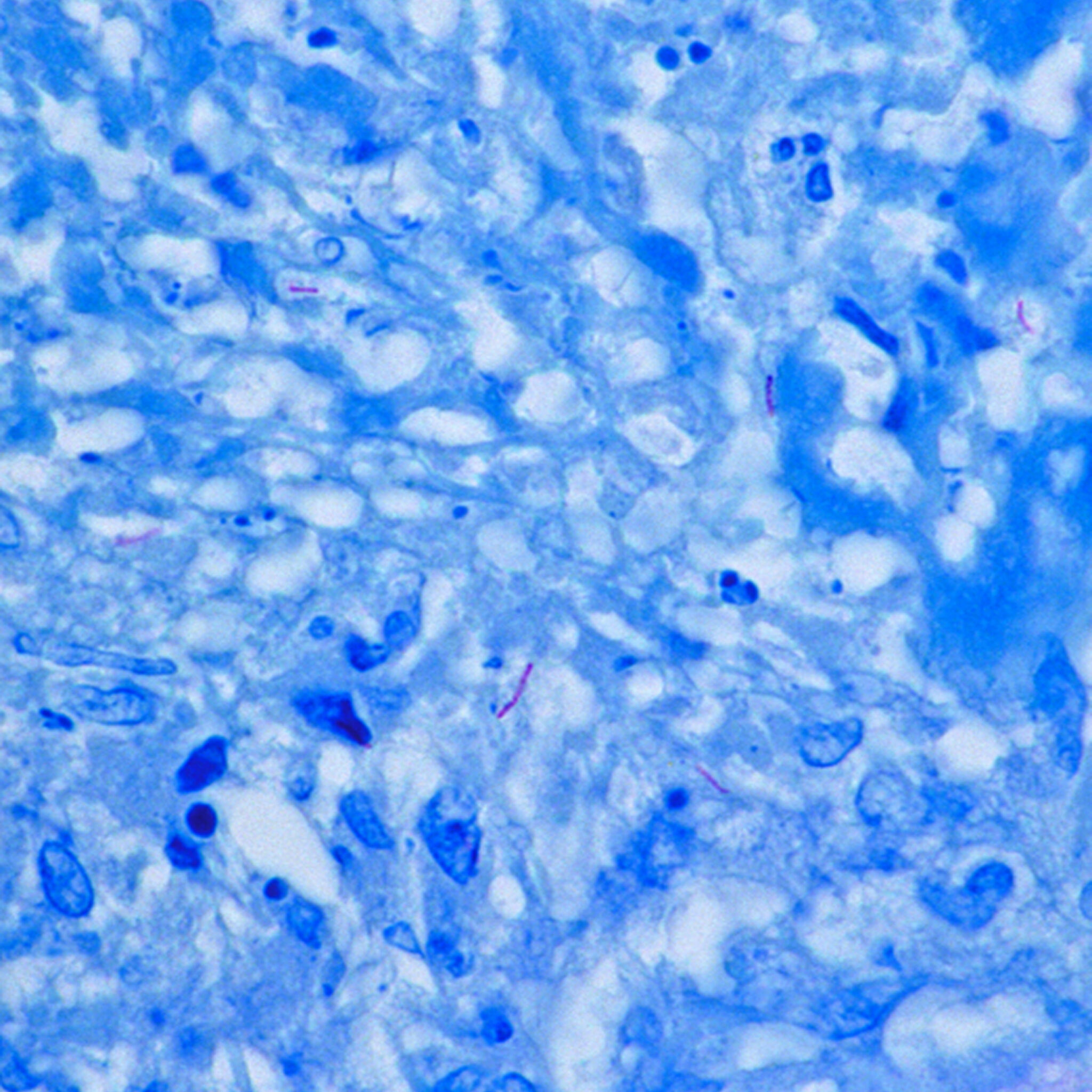 Methylene Blue Dosage Guide Safe & Effective Instructions